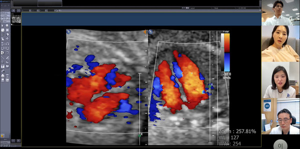 보호자와 산모, 2차 의료기관(미즈메디병원 전진동 진료부장), 세브란스병원(권하얀 산부인과 교수) 주치의가 산모의 초음파 검사 결과를 함께 보며 협진을 하는 모습