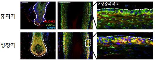 휴지기 모낭과 성장기 모낭에서 ALDH2 발현 비교. 면역염색 분석 결과, 주로 모낭의 가장 바깥쪽 층(모낭상피세포층)에서 성장기에 ALDH2가 뚜렷하게 나타났다