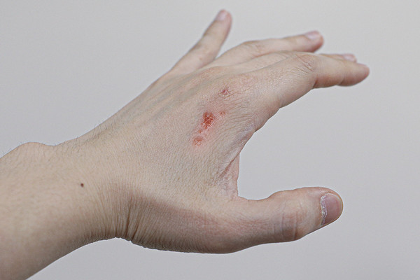                                                                                                                      자료:고려대의료원