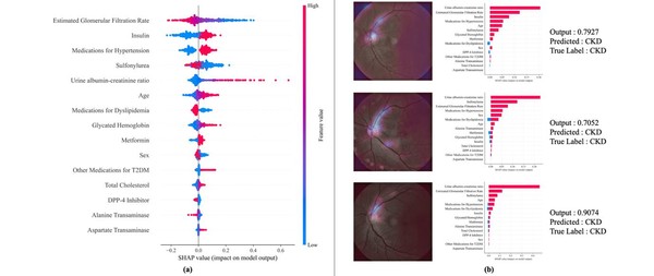 사진=설명 가능한 AI 기법을 통한 주요 위험 인자 기여도 시각화 결과.