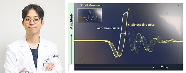 사진=흉부외과 임공민 교수, 혈전의 유무에 따란 초음파 센서상의 파형 변화.
