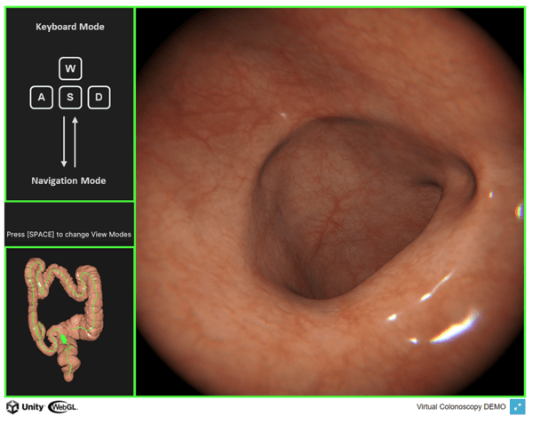사진=AI 기반 내시경 시뮬레이터(SeamXSim-T) 구동 화면.
