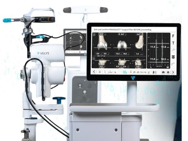 사진=인공관절 수술 로봇 '벨리스 로봇'.